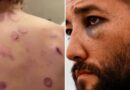 Coalición Flotilla de la Libertad denunció que los  activistas internacionales detenidos por Israel fueron objeto de «abuso y trato degradante»